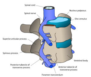 ACDF_oblique_annotated_english