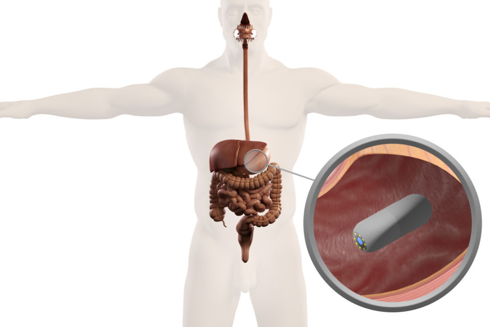 Capsule Endoscopy GlobeHealer