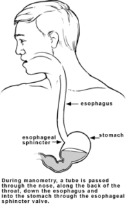 esoph manometry